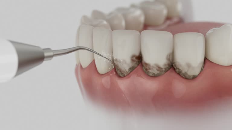Reliable Wisdom Tooth Removal contractor in Berrien County County, GA by Dentist Open Now